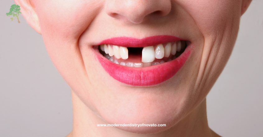Missing tooth