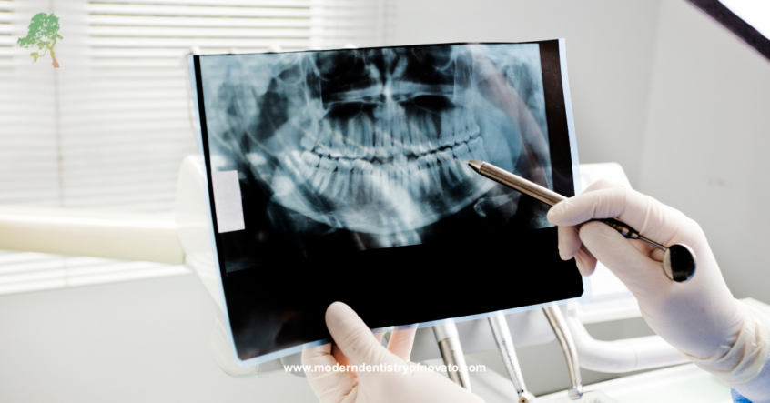 Dental X-Rays