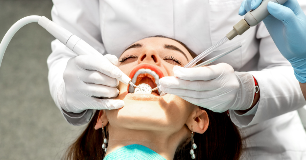 Professional Teeth Cleaning