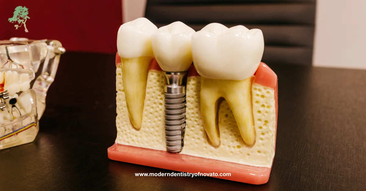 Missing tooth treatment