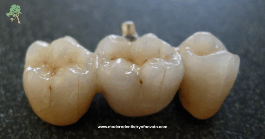 Porcelain teeth