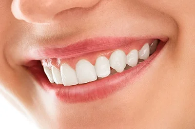 Gums