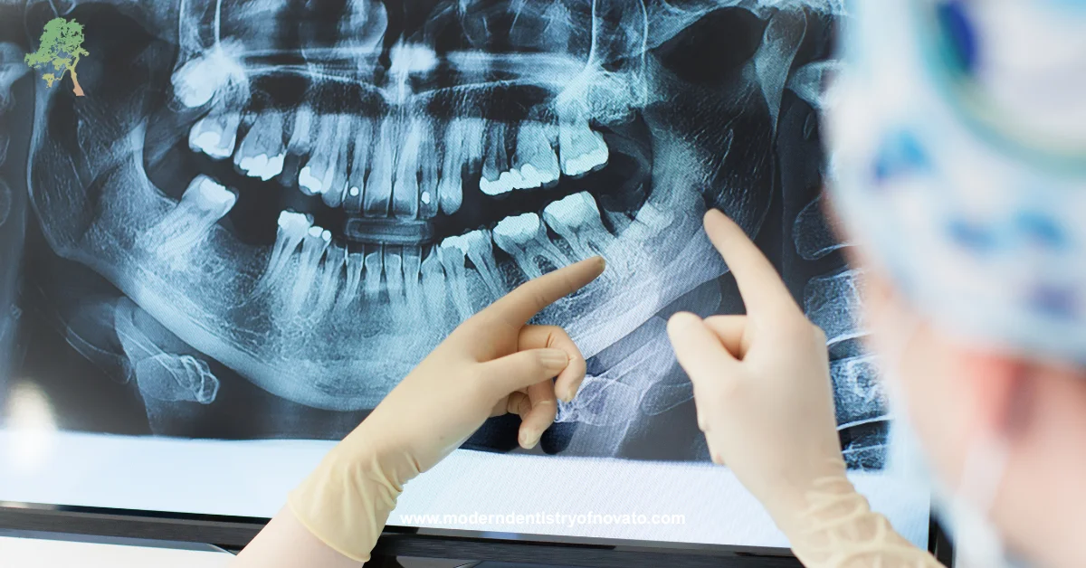 Dental X-Rays