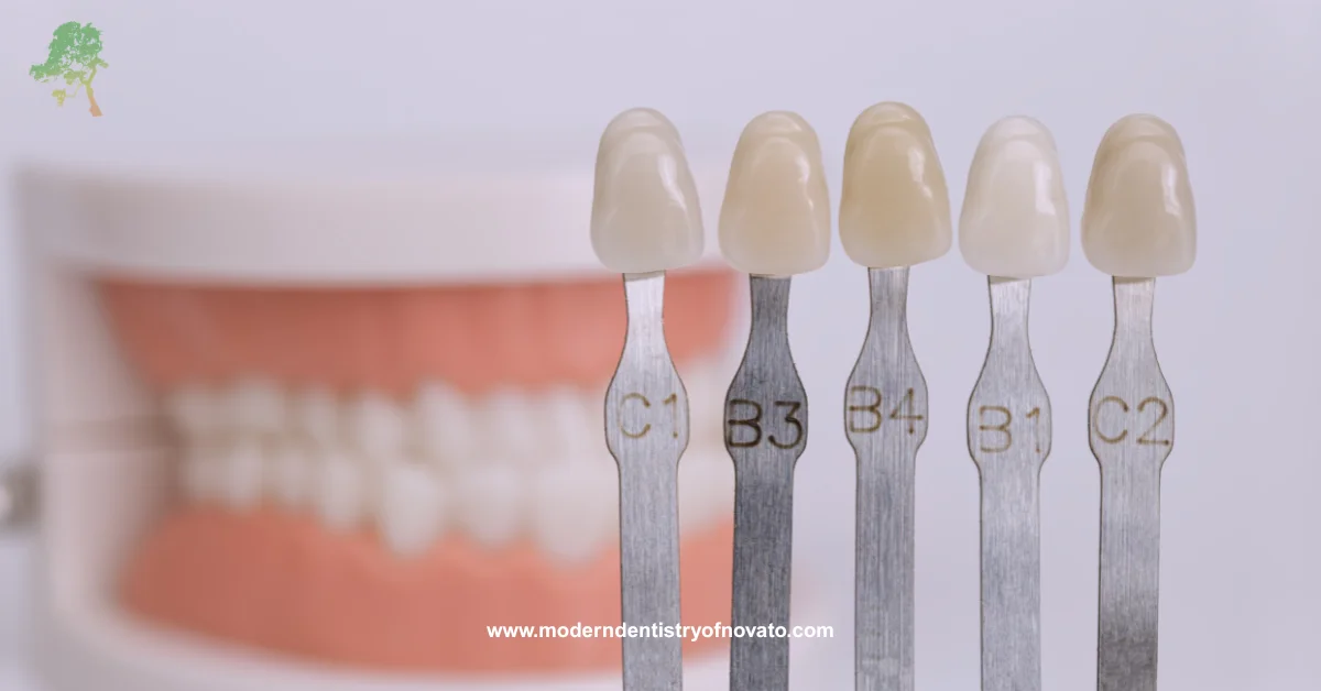 Porcelain Veneers