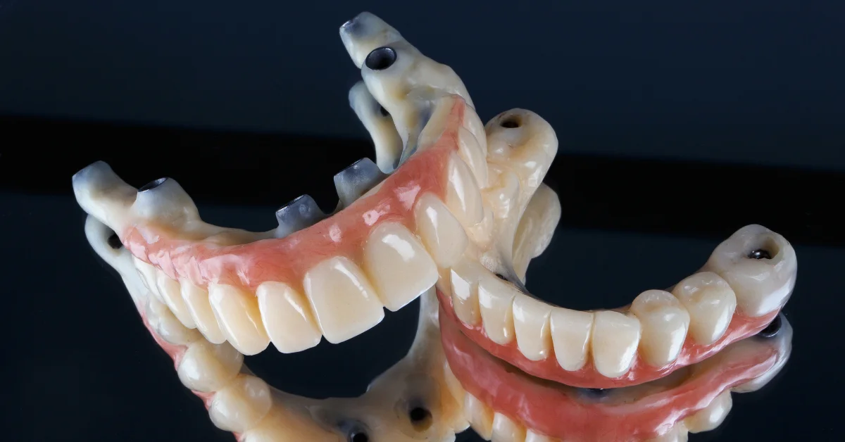 Featured image for “Who Is a Good Candidate for Full Mouth Dental Implants?”